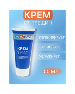 Крем для ног от трещин в ступнях, "", 50 мл До и после